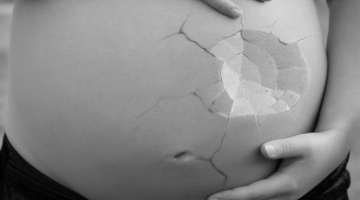 El Obispo de los Ángeles, Monseñor Felipe Bacarreza, expresó su dolor durante la homilía. Donde sostuvo que promulgando la ley a favor del aborto, se atenta contra el mandato de Dios.
